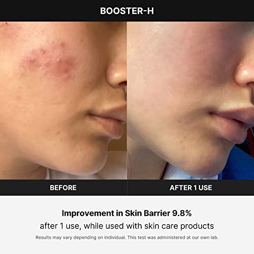 Medicube Age-R Booster H - Maximizing and Boosting Skin Care Absorption